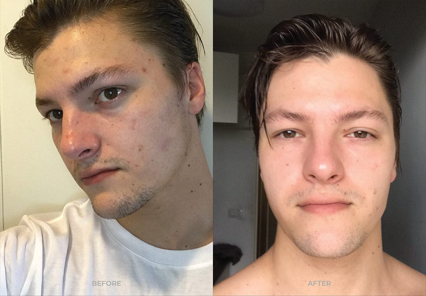 Paul S. transformation